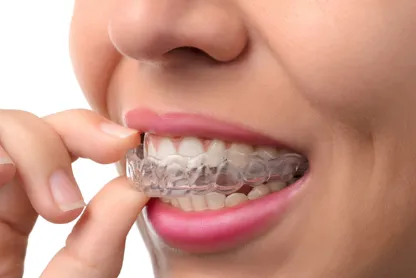 Invisalign Treatment: Easy and Discreet – Woman inserting an Invisalign tray into her mouth.