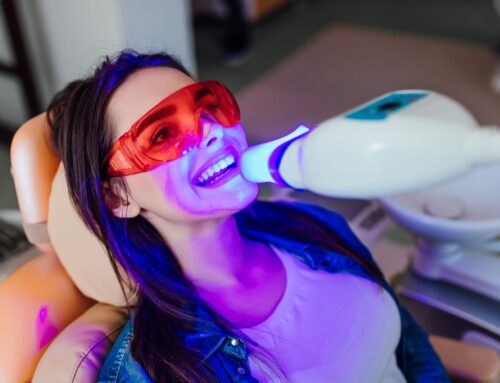 The Truth About Teeth Whitening: Pro vs. DIY Options